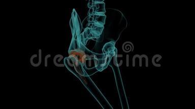 带有金属假体的人体骨骼三维渲染动画X射线图像